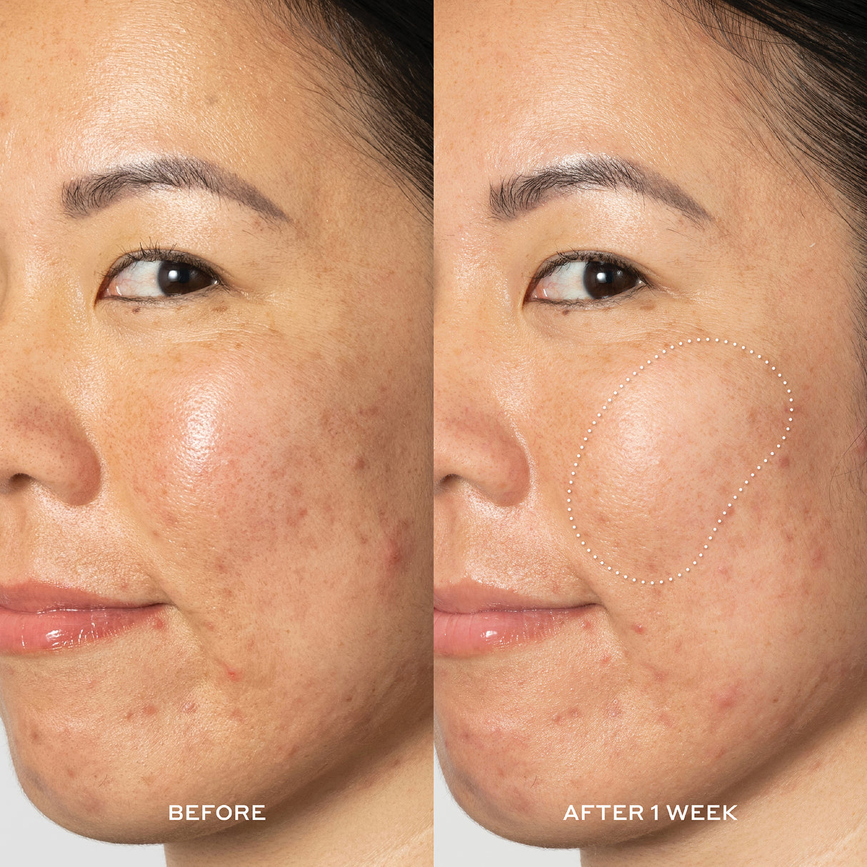 Transform Glow2OH Dark Spot Toner