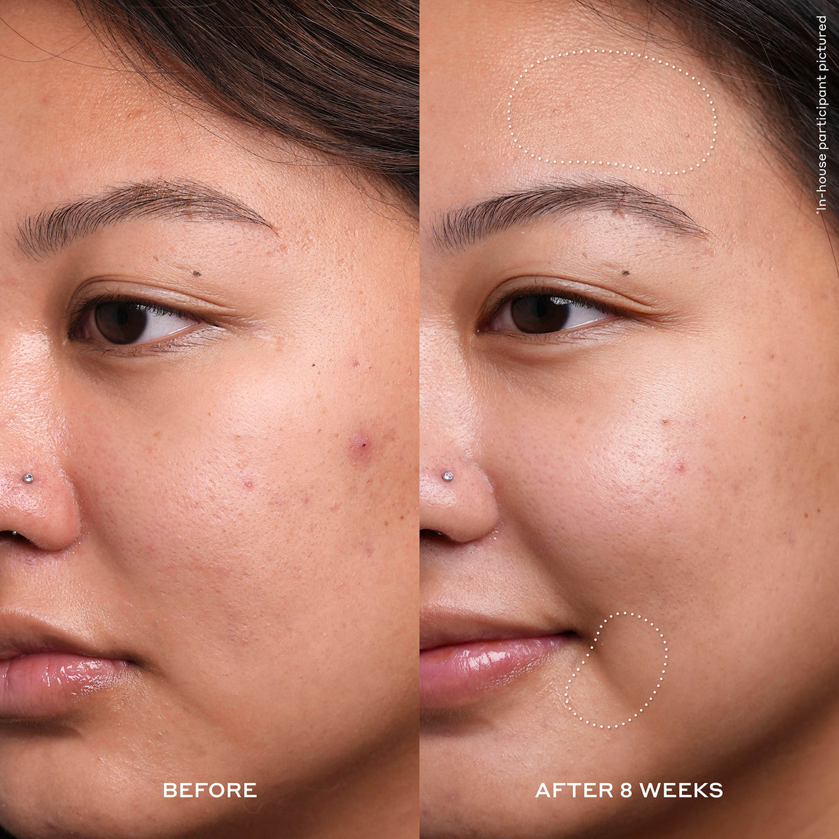 Dewtopia 20% Acid Night Treatment 30ml