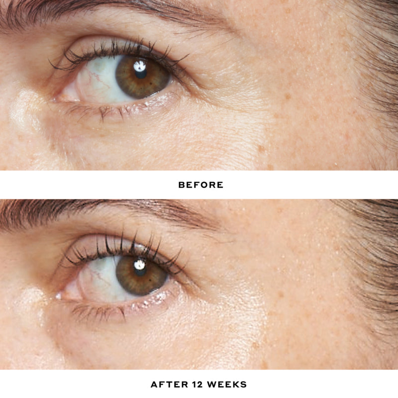 Transform Retinol Age-Fighting Serum