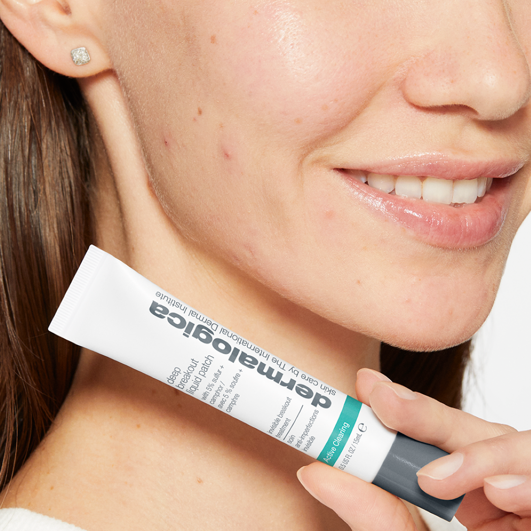 Active Clearing® Deep Breakout Liquid Patch 15ml