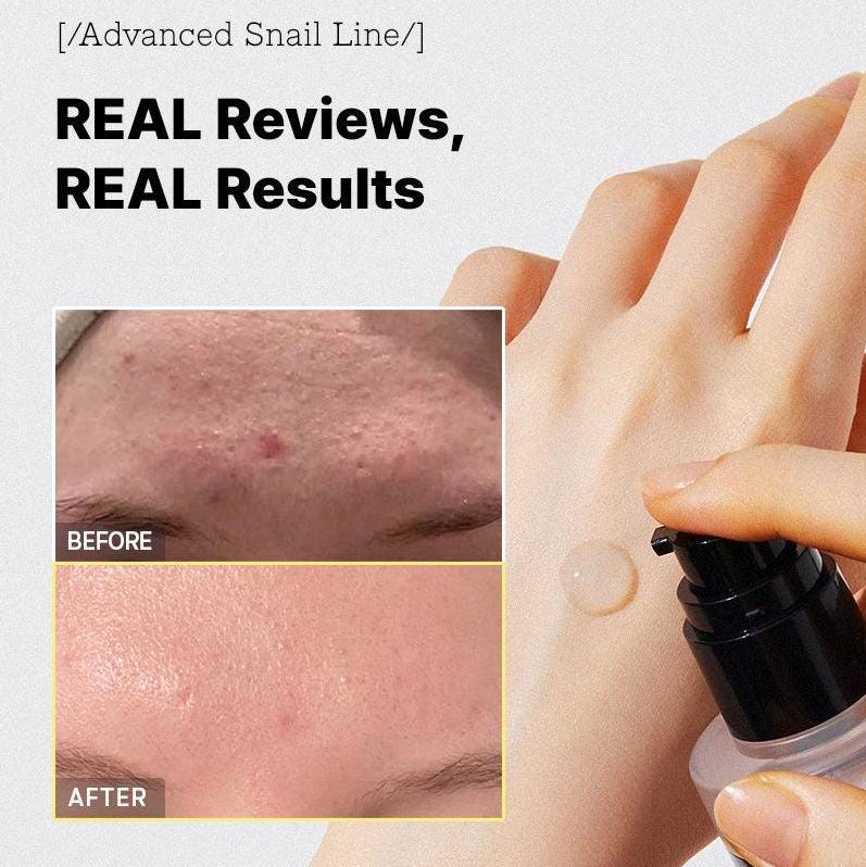 Advanced Snail 96 Mucin Power Essence