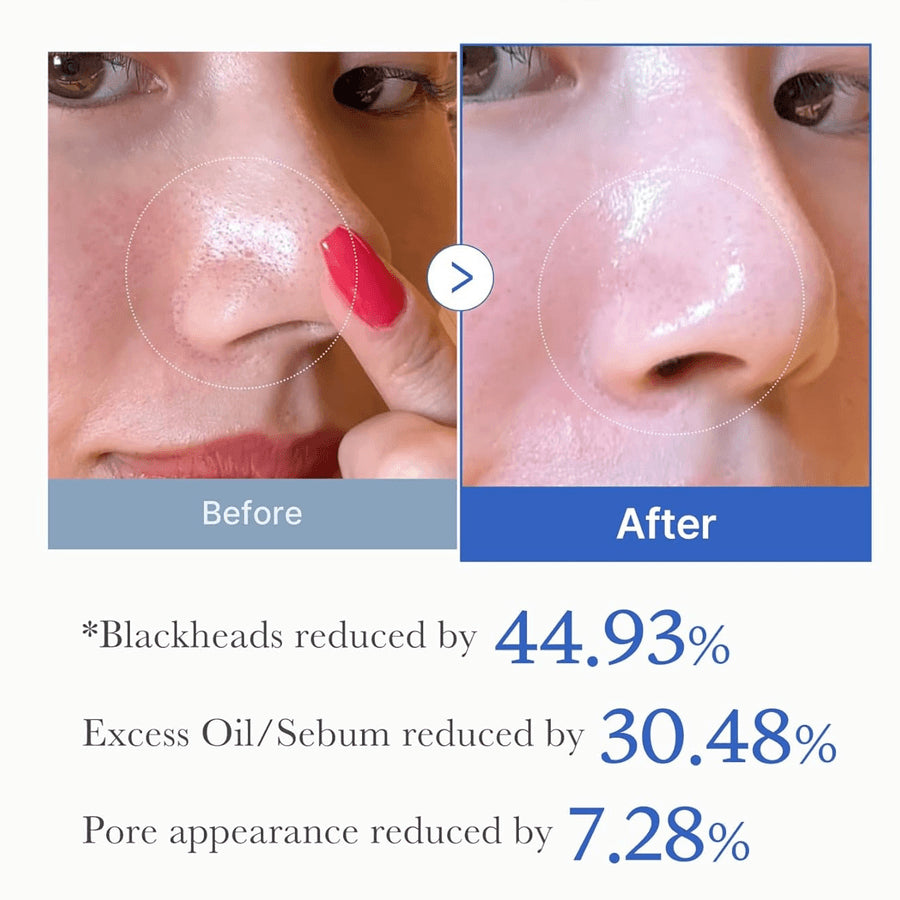 Zero Pore Pad 2.0 70 pads