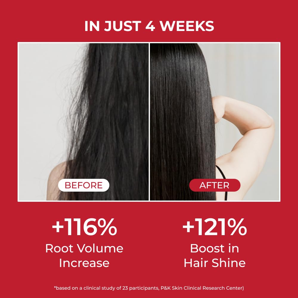 Annurcatin Shampoo 300 ml