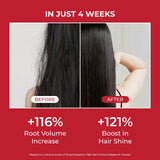 Annurcatin Shampoo 300 ml