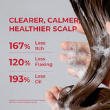 Annurcatin Shampoo 300 ml