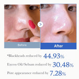 Zero Pore Pad 2.0 70 pads